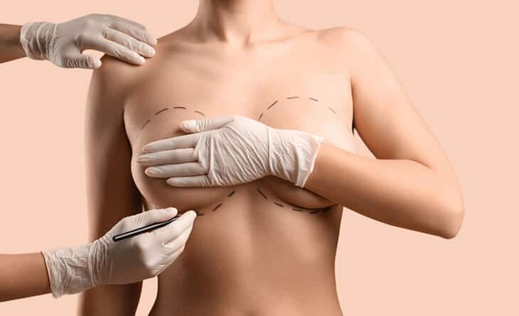 breast surgery types