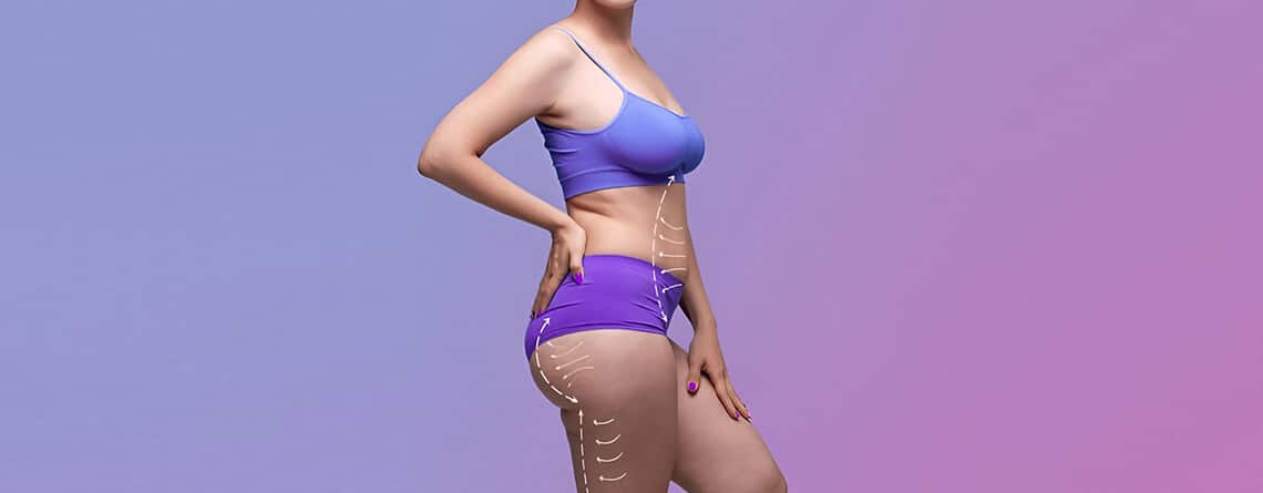 High-Definition Abdominoplasty in Delhi