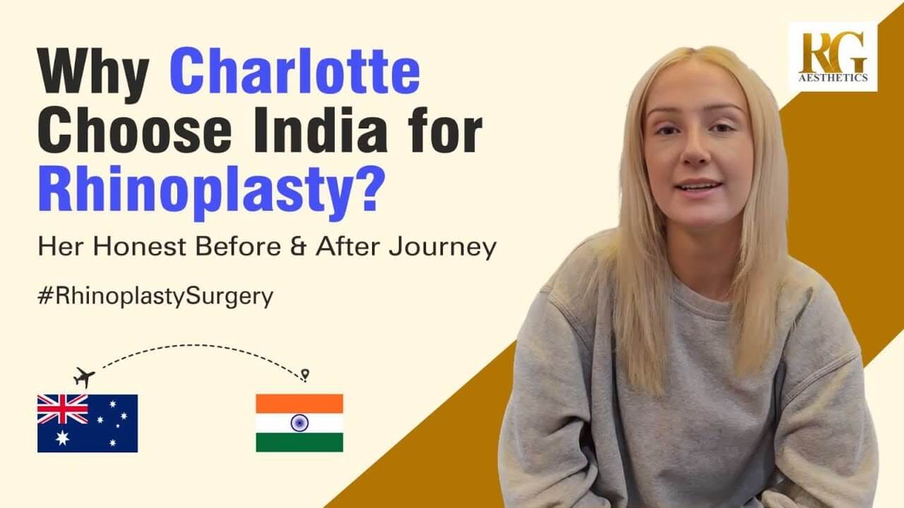 Why Charlotte Choose India for Rhinoplasty - Rhinoplasty Surgery Before And After (1)