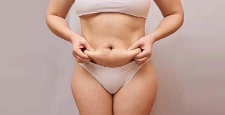 Liposuction Care After Surgery - Liposuction Surgery Cost in Delhi - Dr Rajat Gupta