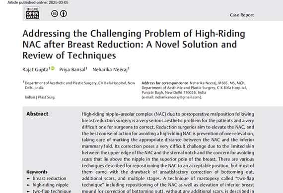 Addressing-the-Challenging-Problem-of-High-Riding-NAC-after-Breast-Reduction