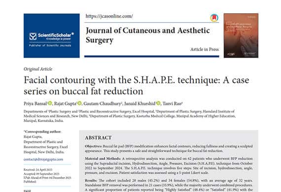 Facial-contouring-with-the-SHAPE-technique