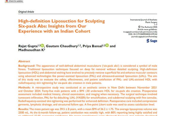 High-definition Liposuction for Sculpting Six-pack Abs- Insights from Our Experience with an Indian Cohort - Dr Rajat Gupta