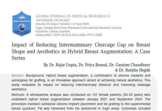 Impact-of-Reducing-Intermammary-Cleavage-Gap-on-Breast-Shape-and-Aesthetics-in-Hybrid-Breast-Augmentation