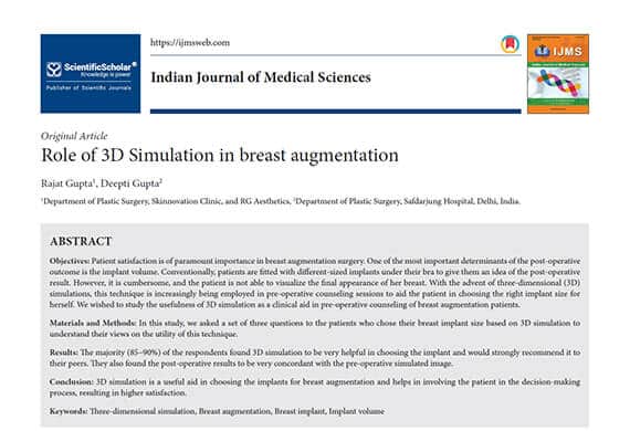 Role-of-3D-Simulation-in-breast-augmentation