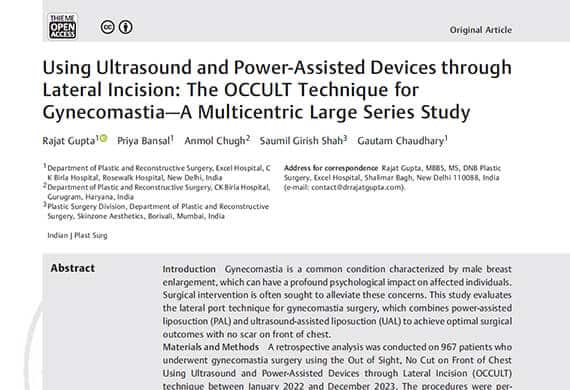 Using-Ultrasound-and-Power-Assisted-Devices-through-Lateral-Incision-The-OCCULT-Technique-for-Gynecomastia